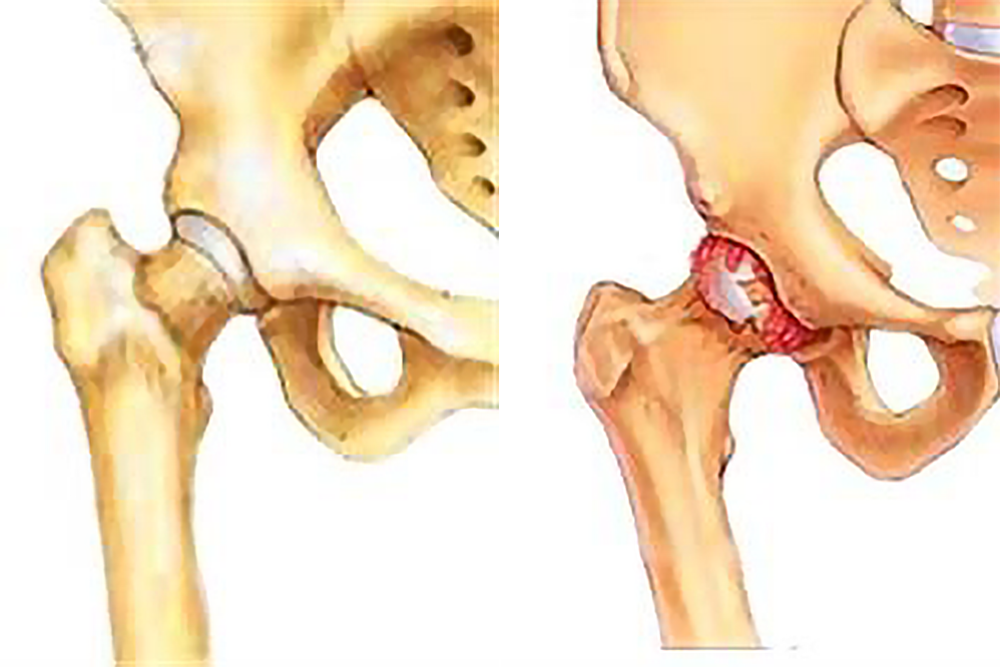 Et nærbilde av en menneskekropp