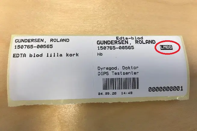 etikett med pasientnamn og informasjon