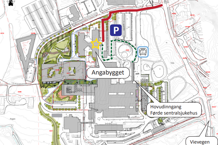 Kart tilkomst Angabygget