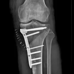 Baksiden av en persons kropp